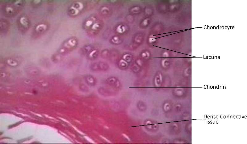 Hyaline Cartilage micrograph